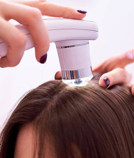 اسکراب اسکالپ